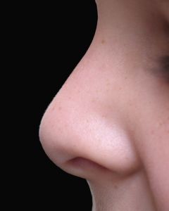 802812_nose_1 802812_nose_1